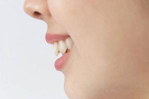 痛みを感じないホワイトニングのサイト